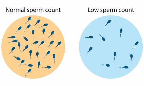 Sperm count